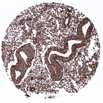 Vimentin antibody