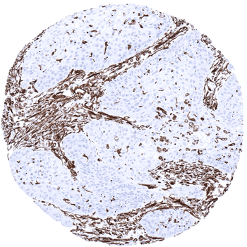 Vimentin antibody