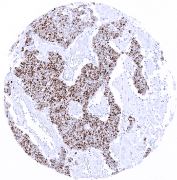 TdT antibody