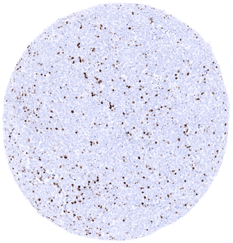 TdT antibody