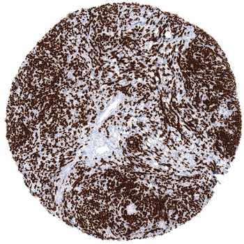 TdT antibody