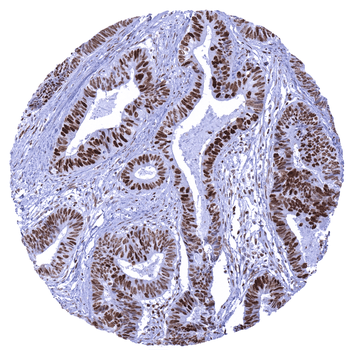 MSH6 antibody