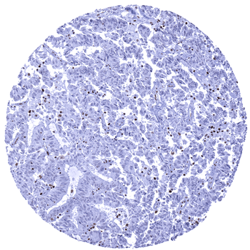 MSH6 antibody