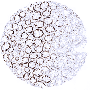 MSH6 antibody