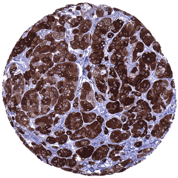Inhibin Alpha antibody