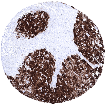 Inhibin Alpha antibody