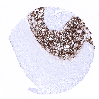PLAP antibody