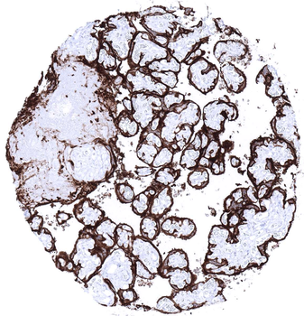 PLAP antibody