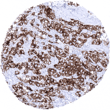 PLAP antibody