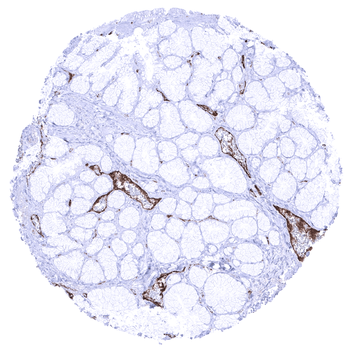 von Willebrand Factor / vWF antibody