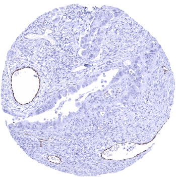 von Willebrand Factor / vWF antibody