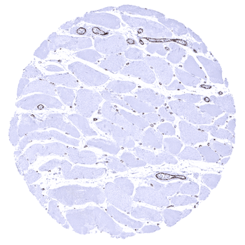 von Willebrand Factor / vWF antibody
