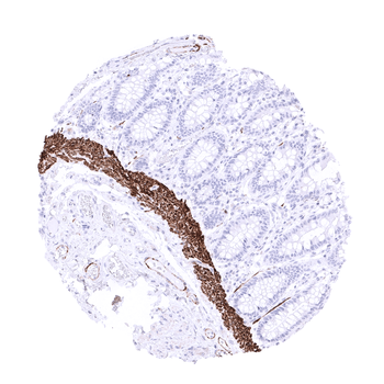 Desmin antibody