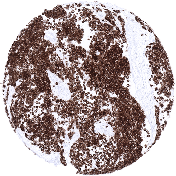 Desmin antibody