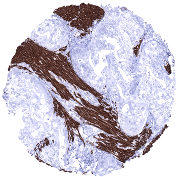 Desmin antibody