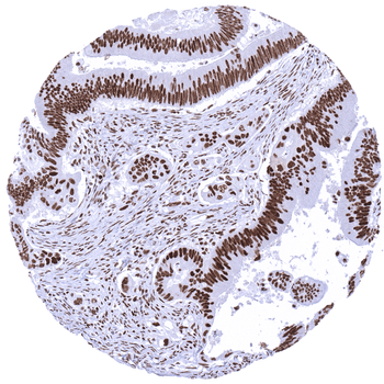 MSH2 antibody
