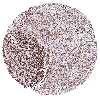 MSH2 antibody