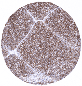 CD1a antibody