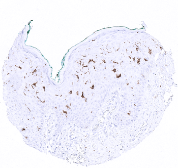 CD1a antibody