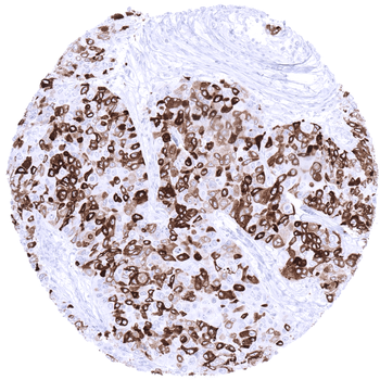 Mammaglobin antibody
