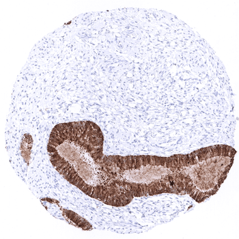 Mammaglobin antibody