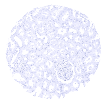 PTH antibody