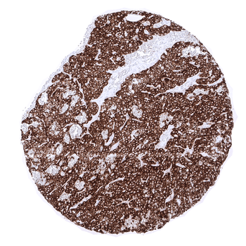 PTH antibody