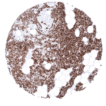PTH antibody