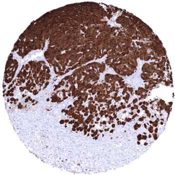 S100 antibody