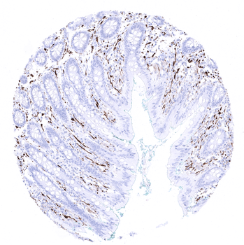 S100 antibody