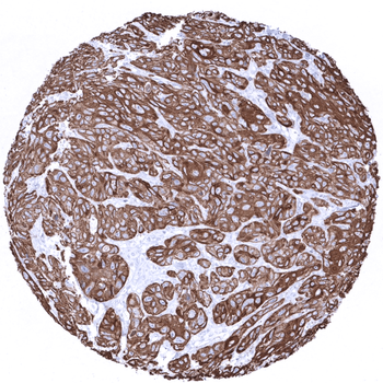 Cytokeratin 6 antibody (MSVA-606R)