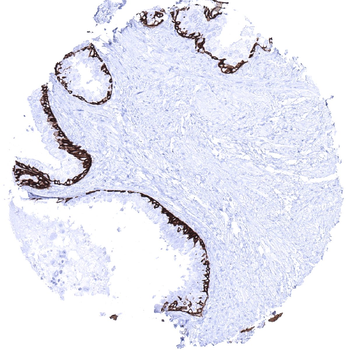 Cytokeratin 5 antibody