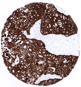 Cytokeratin 5 antibody