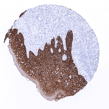 Cytokeratin 5 antibody