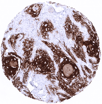 Cytokeratin 10 antibody (MSVA-610M)