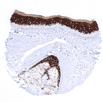 Cytokeratin 10 antibody