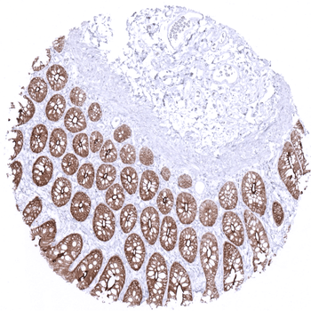 Villin antibody