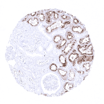 Villin antibody