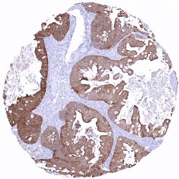 Villin antibody