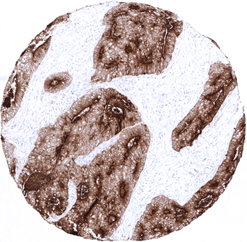 CEA antibody