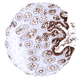 CEA antibody