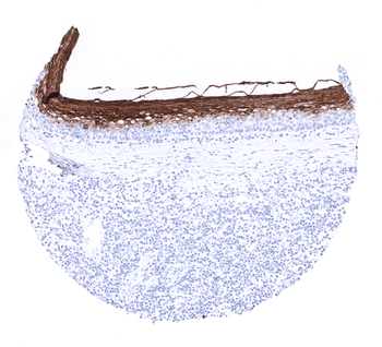 CEA antibody