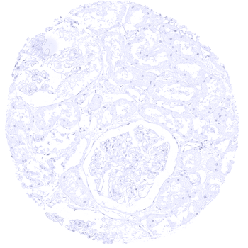 S100P antibody