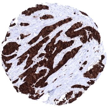 S100P antibody