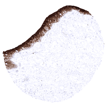 S100P antibody