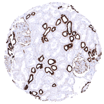 MUC1 / EMA antibody