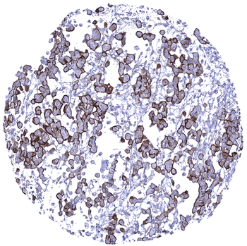 MUC1 / EMA antibody
