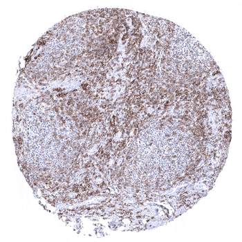 CD27 antibody