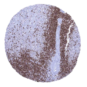 CD22 antibody (MSVA-022R)
