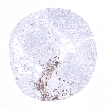 CD20 antibody